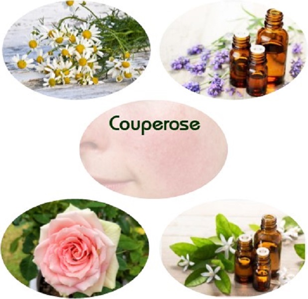 Couperose Skin Blend - Click Image to Close